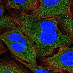 SNF8 Antibody, Novus Biologicals 25 &mu;L, Unlabeled:Antibodies, Polyclonal